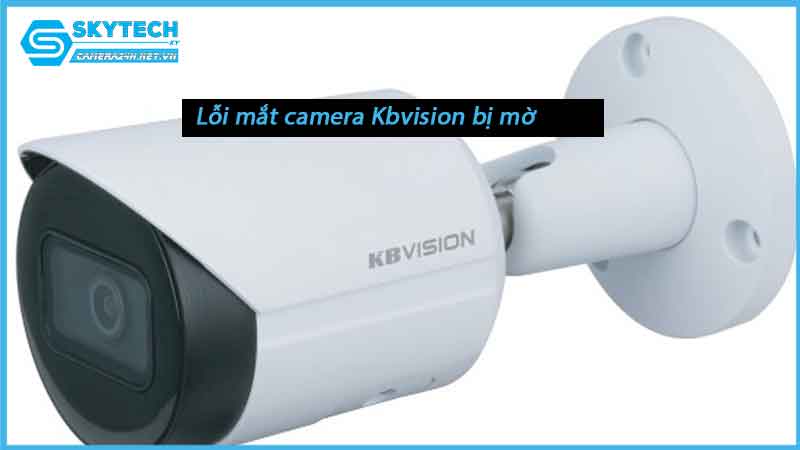 loi-mat-camera-kbvision-bi-mo-1